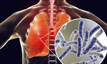 Туберкульоз