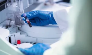 Как сдавать кровь на гематологический анализ?