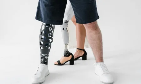 Протези на замовлення: чому важливо мати індивідуальну консультацію з фахівцями «Теллус»