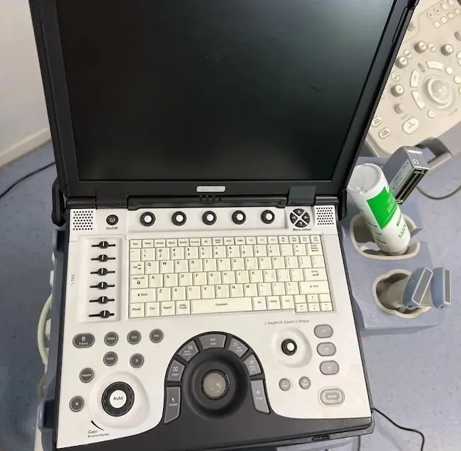 Сучасні портативні та стаціонарні апарати УЗД: де застосовуються та які є переваги?