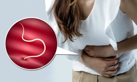 Як розпізнати глисти